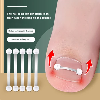 Инструменты для коррекции вросших ногтей на ногах, восстанавливающие для педикюра, для вросших ногтей на ногах, Профессиональное средство для коррекции вросших ногтей на ногах